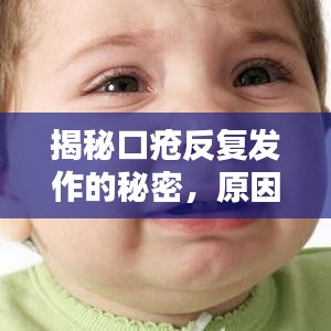 揭秘口疮反复发作的秘密，原因何在？