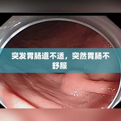 突发胃肠道不适，突然胃肠不舒服 