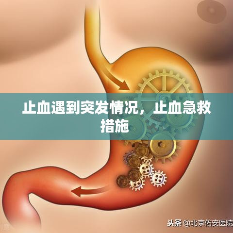 止血遇到突发情况，止血急救措施 