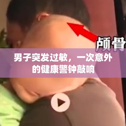 男子突发过敏，一次意外的健康警钟敲响