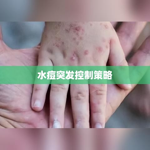 水痘突发控制策略
