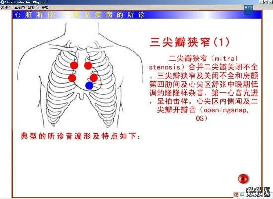 心肺听诊官方下载及安全评估策略MT_v3.119使用教程——从零开始